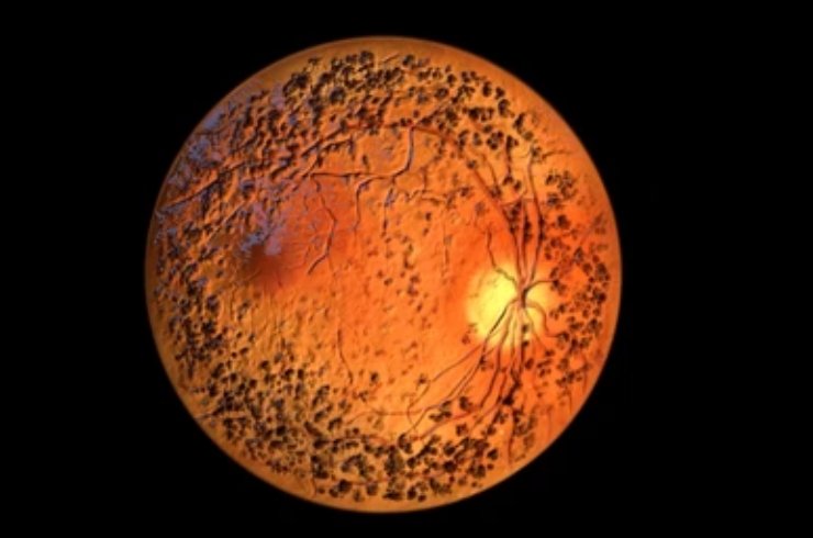 Om Netra Kendra & Laser Vision, Dr. HARSH VARDHAN GUPTA