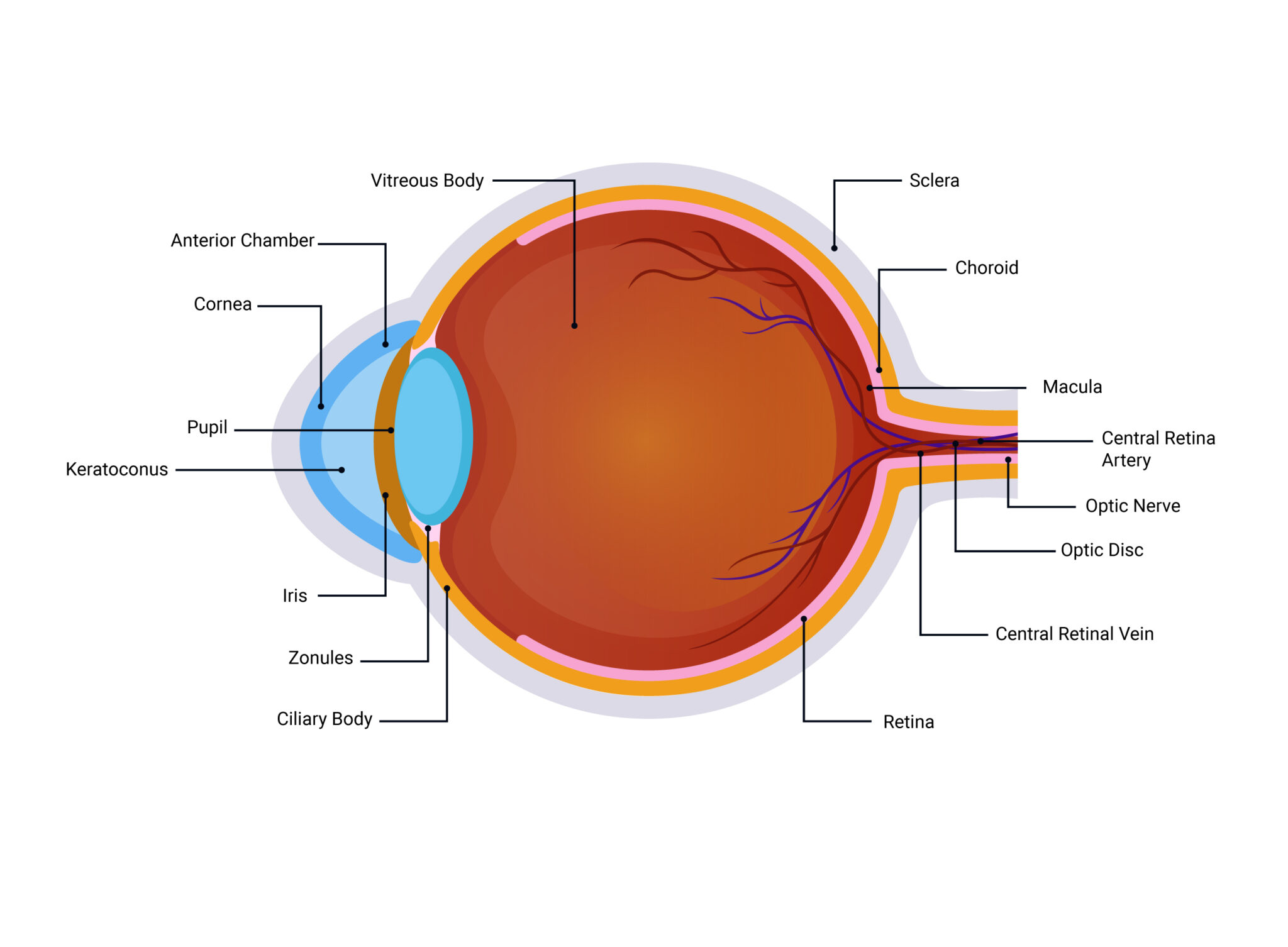 Keratoconus - om netra kendra laser vision